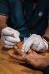 Hepatitis C en los campos Rohingyas en Bangladesh