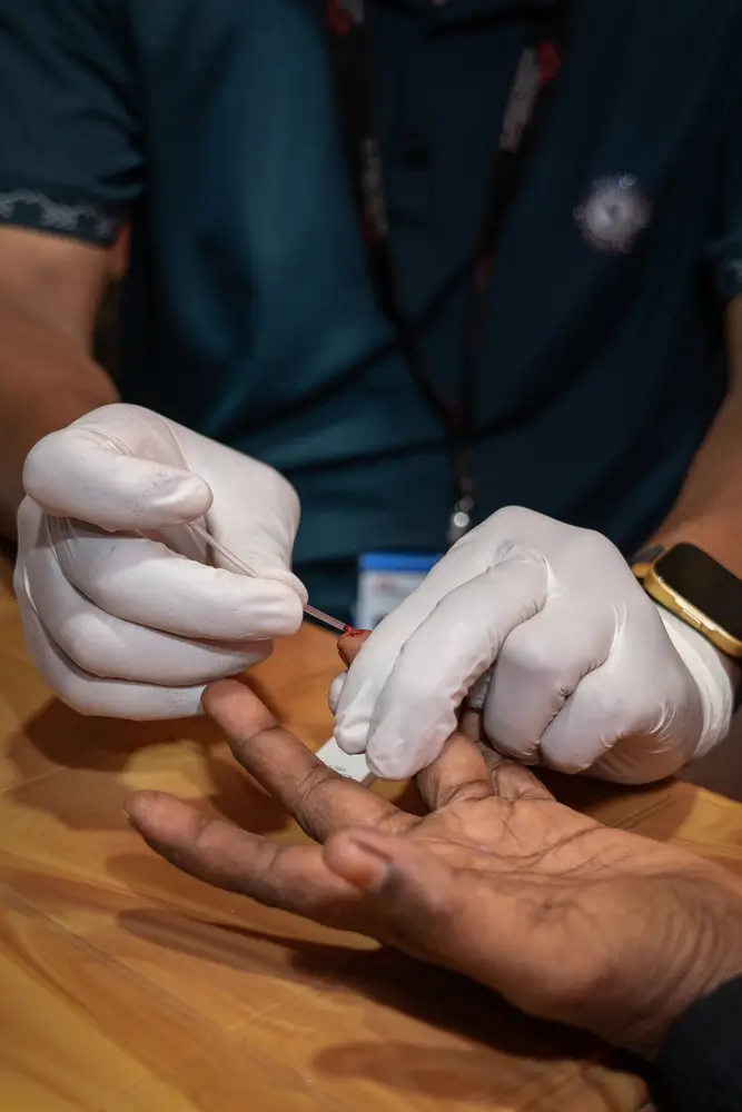 Hepatitis C en los campos Rohingyas en Bangladesh