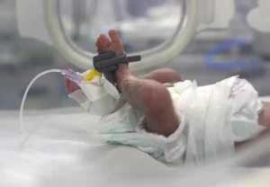 Recién nacido bajo seguimiento en la unidad de cuidados intensivos neonatales apoyada por MSF en el hospital Nasser,en Gaza.