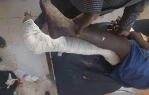 Un paciente del Hospital Universitario Nyala, que apoyamos, tras los ataques aéreos del 3 de febrero de 2025. Sudán