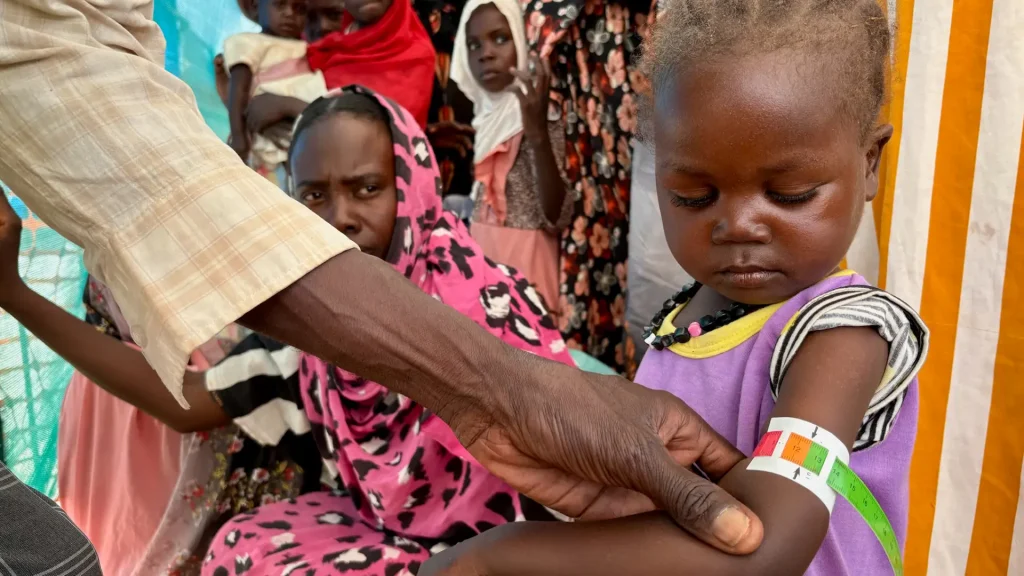 Un miembro del personal de MSF mide la circunferencia media del brazo (CMB) de Nouran Abdallah, de 2 años, quien huyó de El Fasher el 11 de octubre con su familia. La medición muestra desnutrición aguda moderada; será inscrita en el programa de la Clínica de Desnutrición Aguda Moderada en el campamento de desplazados de Dabaniera.