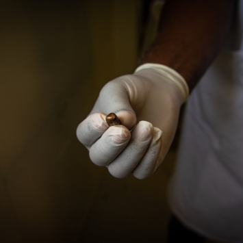 Un integrante de MSF muestra una bala extraída de un paciente que recibió un disparo en su vecindario. © Johnson Sabin