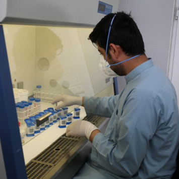 Diagnóstico de tuberculosis.