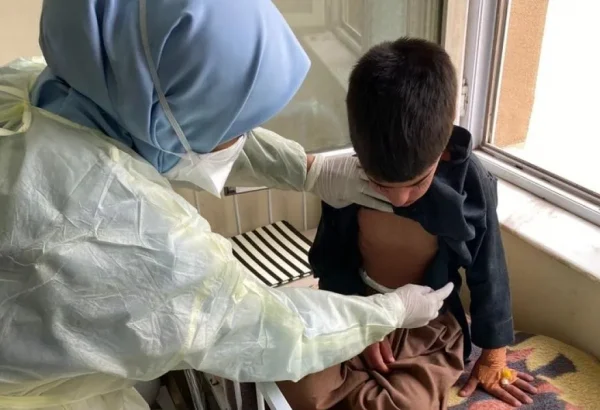 Una enfermera de MSF examina a Sebgatullah, de nueve años, diagnosticado de sarampión, en la sala de aislamiento del Hospital Regional de Herat.