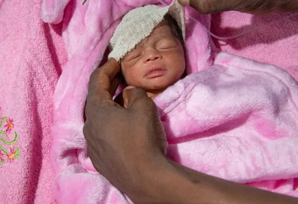 La bebé prematura Isha Ali Modu, un día después de su nacimiento. Maiduguri, estado de Borno, Nigeria
