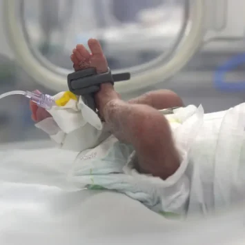 Recién nacido bajo seguimiento en la unidad de cuidados intensivos neonatales apoyada por MSF en el hospital Nasser,en Gaza.