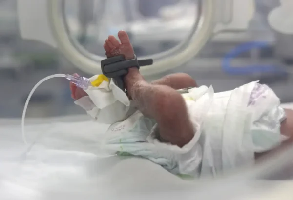 Recién nacido bajo seguimiento en la unidad de cuidados intensivos neonatales apoyada por MSF en el hospital Nasser,en Gaza.