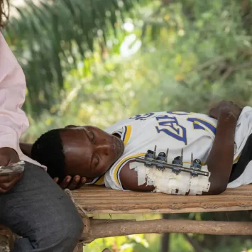 Charles Baraka Chanung iyo, de 18 años, fue atacado por asaltantes mientras dormía en su casa. Recibió heridas de bala en el brazo y de machete en la muñeca.