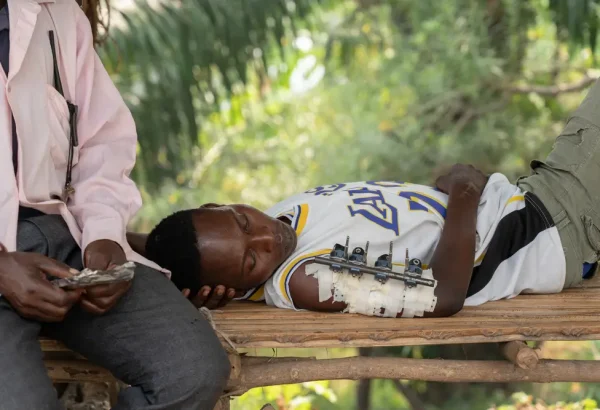 Charles Baraka Chanung iyo, de 18 años, fue atacado por asaltantes mientras dormía en su casa. Recibió heridas de bala en el brazo y de machete en la muñeca.