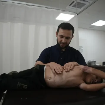 Un fisioterapeuta en consulta con un paciente con quemaduras en el hospital de MSF en Atmeh, al noroeste de Siria.