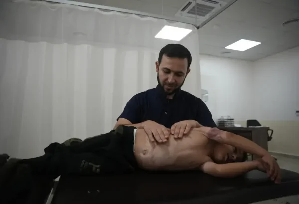 Un fisioterapeuta en consulta con un paciente con quemaduras en el hospital de MSF en Atmeh, al noroeste de Siria.