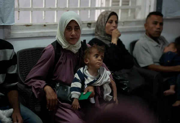 Una madre palestina, identificada como Donia Alouf, de 33 años, y su hijo Ahmed, de un año, fueron diagnosticados con desnutrición. Donia recibe atención médica en una clínica de Gaza en la ciudad de Gaza. Está embarazada de ocho meses y también padece desnutrición.