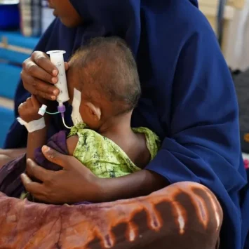 Una mujer sostiene a su hijo, quien sufre desnutrición, y le alimenta con una jeringa en el Hospital Bay Regional que apoyamos en Baidoa, en Somalia.