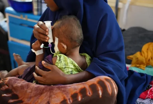 Una mujer sostiene a su hijo, quien sufre desnutrición, y le alimenta con una jeringa en el Hospital Bay Regional que apoyamos en Baidoa, en Somalia.