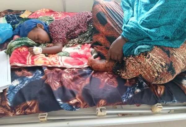 Halima Abdi Adan, ha vivido una pesadilla que ningún padre querría vivir: su hija de dos años, Ahlan, contrajo el sarampión cuando ya estaba debilitada por la desnutrición. Afortunadamente, tras una semana de cuidados intensivos, el estado de la niña mejoró.