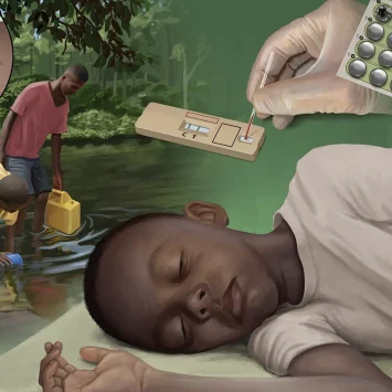 Niño con enfermedad del sueño, mosca tsé tsé, prueba rápida y medicación.