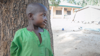 Paciente con noma en Nigeria