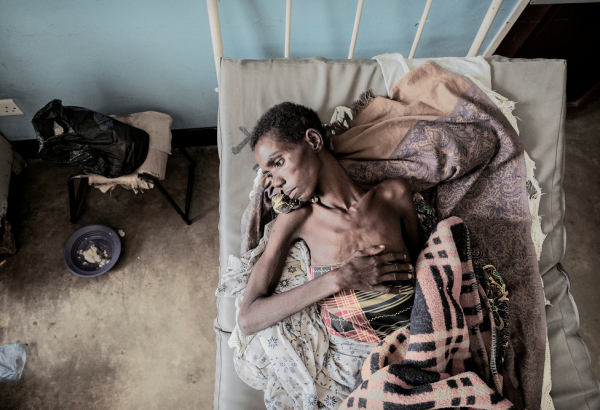 Nsanje: Treating advanced HIV