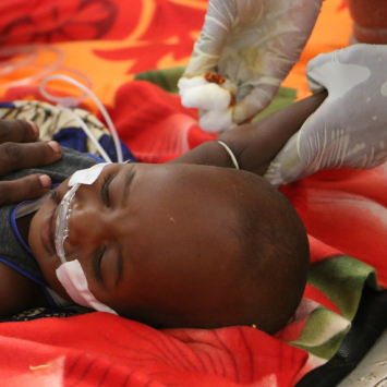 MSF IN CHAD: TACKLING MALNUTRITION IN AM TIMAN
