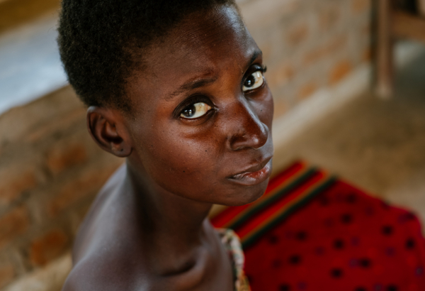 Malawi - Advanced HIV